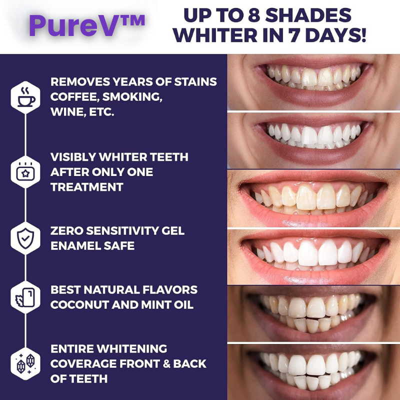 PureV™ - whitening strips