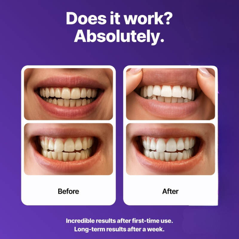PureV™ - whitening strips